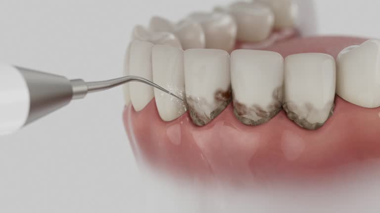 Reliable Tooth Extraction contractor in Woodland, CA by Smile Center Dentistry